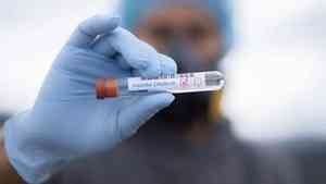 Поморье продолжает бить антирекорды по темпам заражения коронавирусом в стране