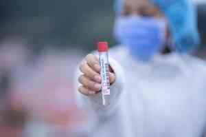 За сутки в Поморье выявлено 72 новых больных коронавирусом