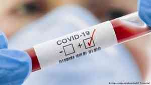 Оперштаб: 744 новых случаев заболевания коронавирусом за сутки