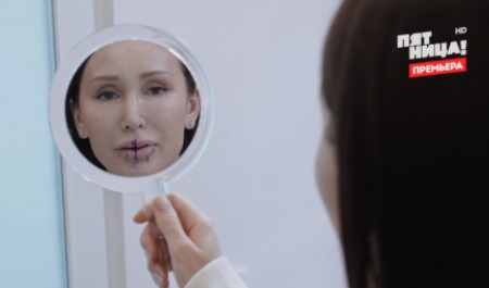 «Этот пластик живет во мне»: россиянки честно рассказали о последствиях увеличения губ «Этот пластик живет во мне»: россиянки честно рассказали о последствиях увеличения губ