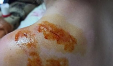 Как собаки Поморье искусали
